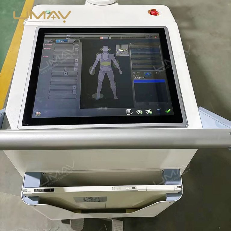 Fairly Priced 25 kW Mobile Digital X‑Ray System for Hospital Radiography-7